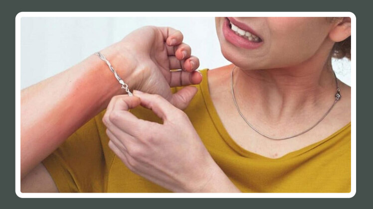 حساسیت به زیورآلات استیل - آیا زیورآلات استیل حساسیتزا هستند؟